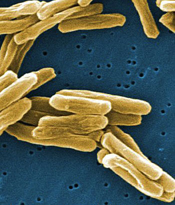 Infections of the germs which cause tuberculosis can lead to death in infected people — if they don’t receive a course of antibiotic treatment. (FILE IMAGE)