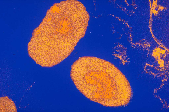 Bordetella pertussis is the bacteria that causes whooping cough, a disease of the lungs and throat that spreads easily from one person to another. (FILE IMAGE)